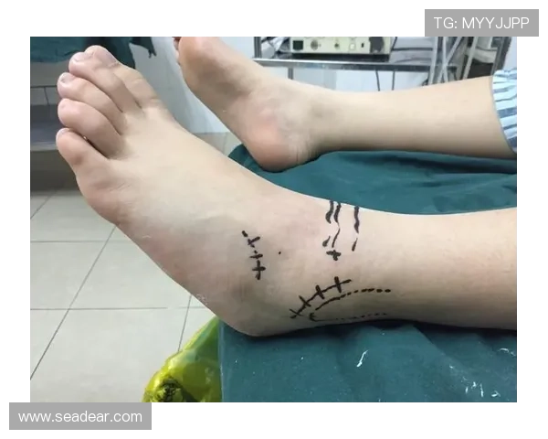 韦斯利利马对抗中伤踝无法落地